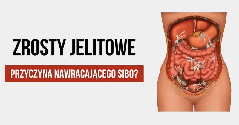 Jaka dieta na zrosty w jamie brzusznej? Co jeść, by łagodzić objawy