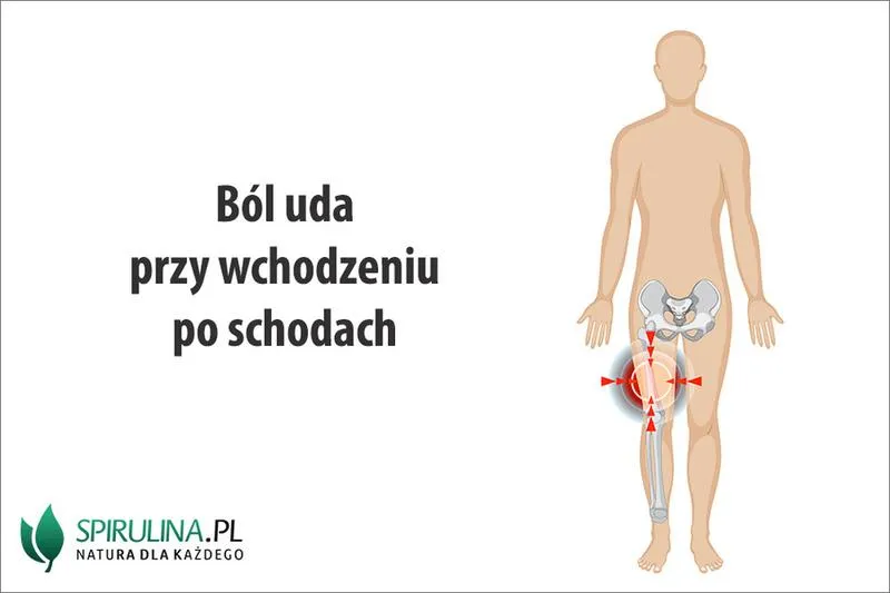 Ból mięśni uda