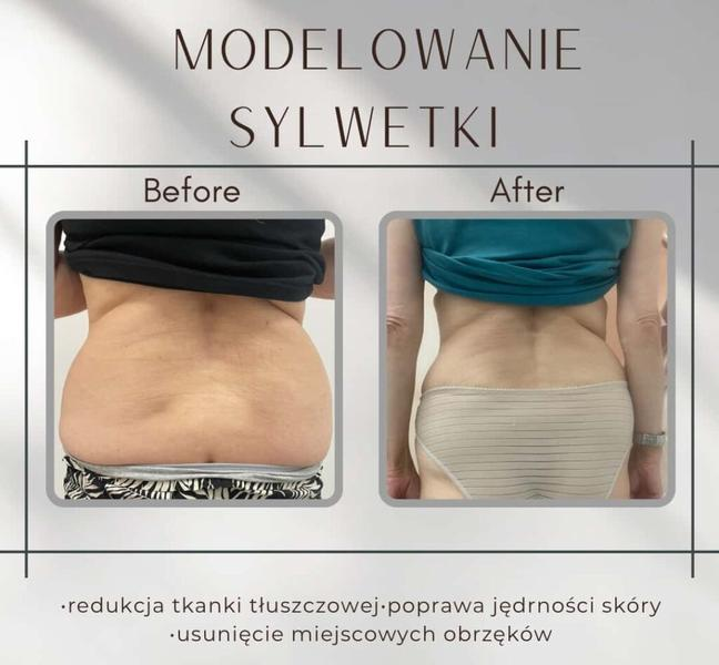 Zdrowe nawyki żywieniowe